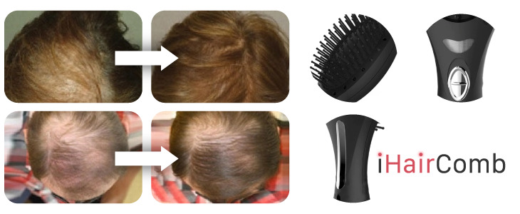 Laser hair growth comb